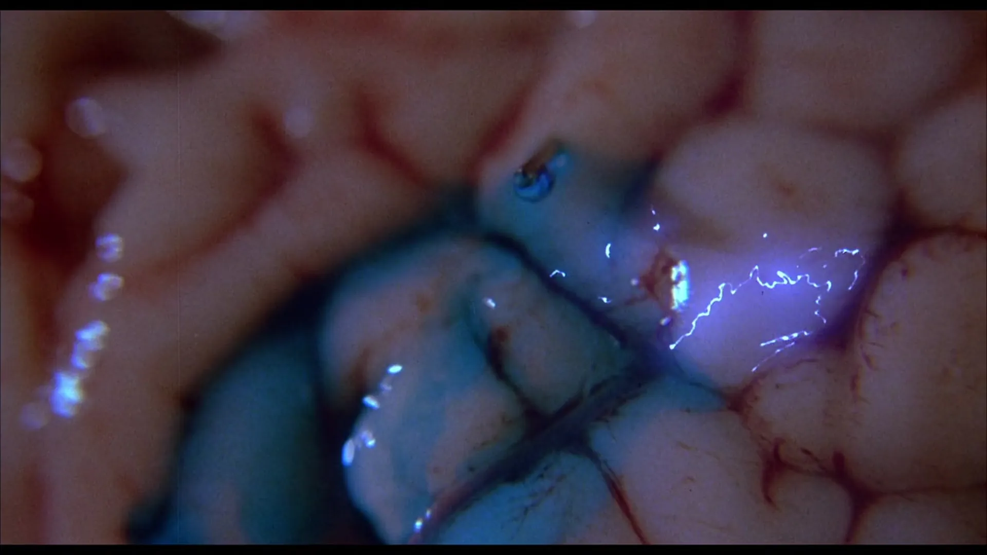Brain Damage scene still 2
